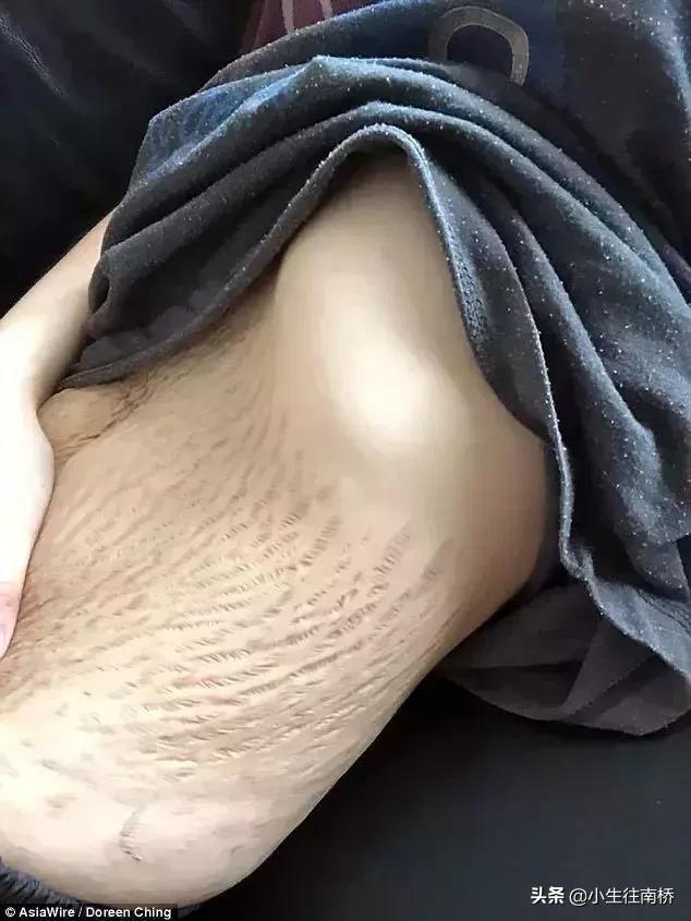 38岁天后自曝产后尿*禁失**:女人拿命生孩子,图什么?!