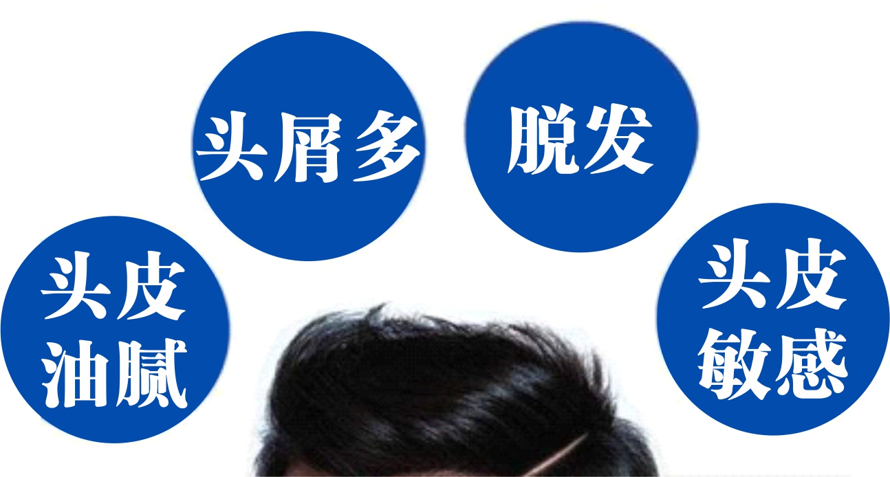 摆脱雪花飘飘大油头，黑耀美发护发还你一头浓密黑发