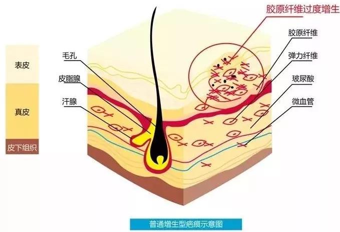 鐧惧痉鍖婚櫌鐤ょ棔淇,鐧惧痉鍖婚櫌鐤ょ棔淇鏂规硶
