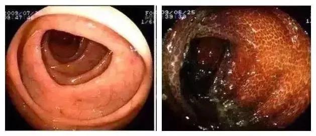 比贩毒利润还高的生意,比贩毒还要赚钱的生意