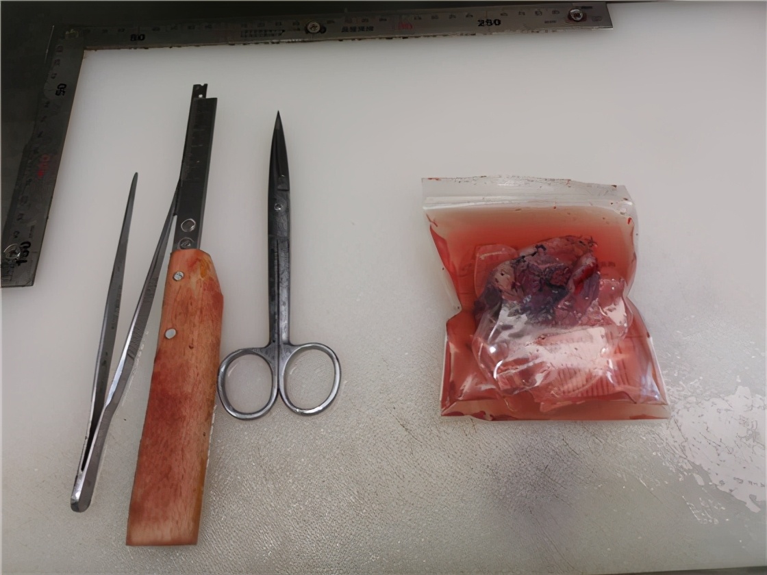 病理讲解视频全集,病理学讲解详细视频