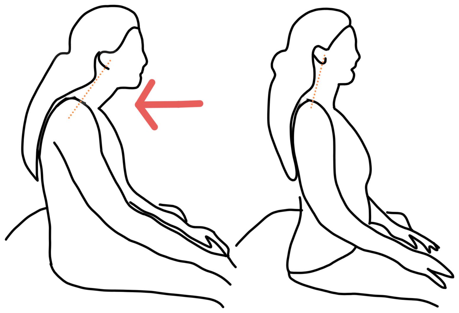 睡醒脖子痛一招搞定,睡醒脖子累怎么缓解