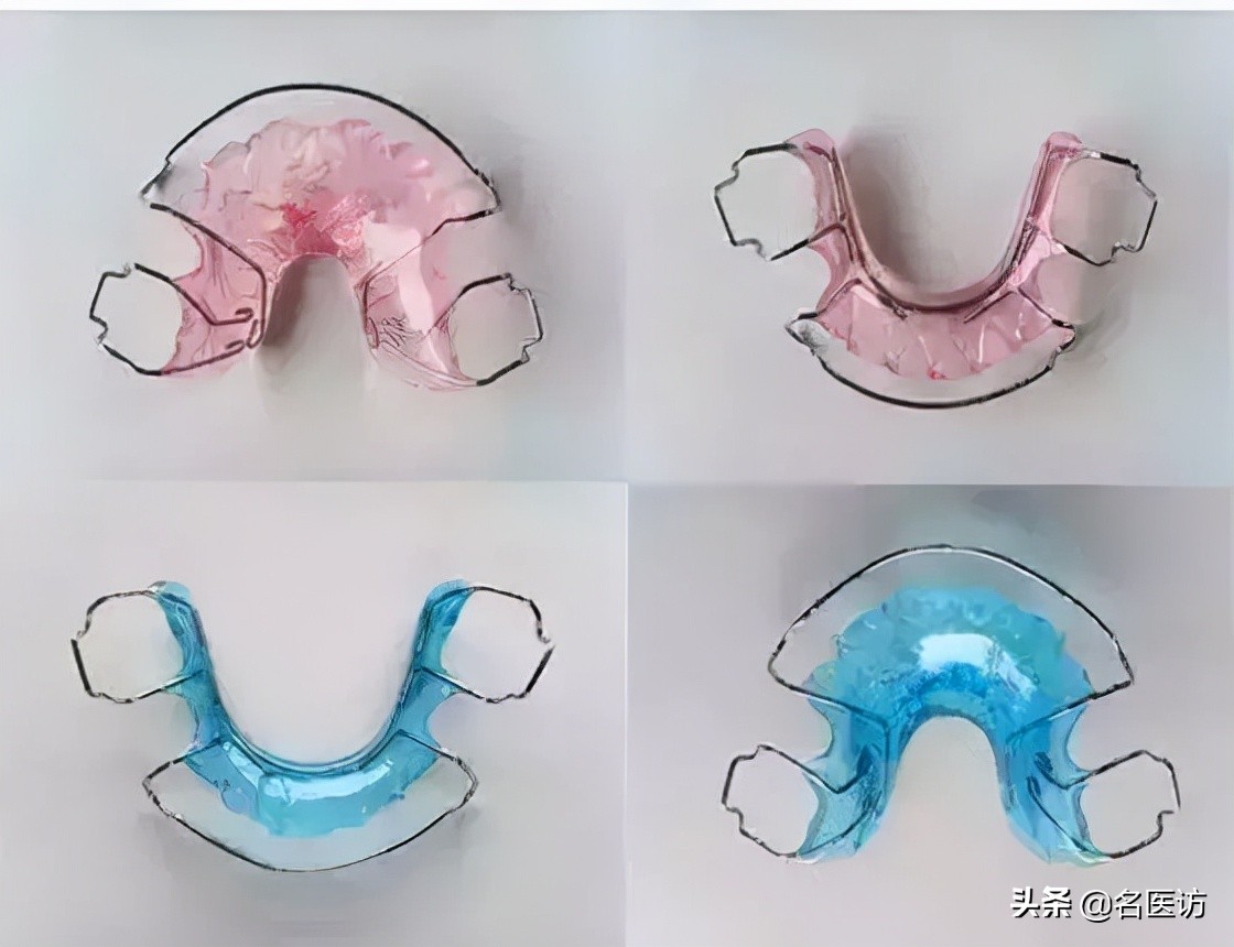 牙齿矫正不戴保持器会全部反弹吗,牙齿矫正保持器戴久了脸会变形吗
