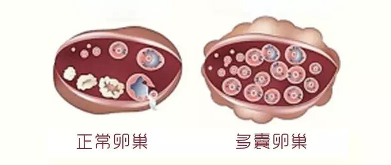 激素药膏太恐怖,激素药物那么可怕为什么要用激素