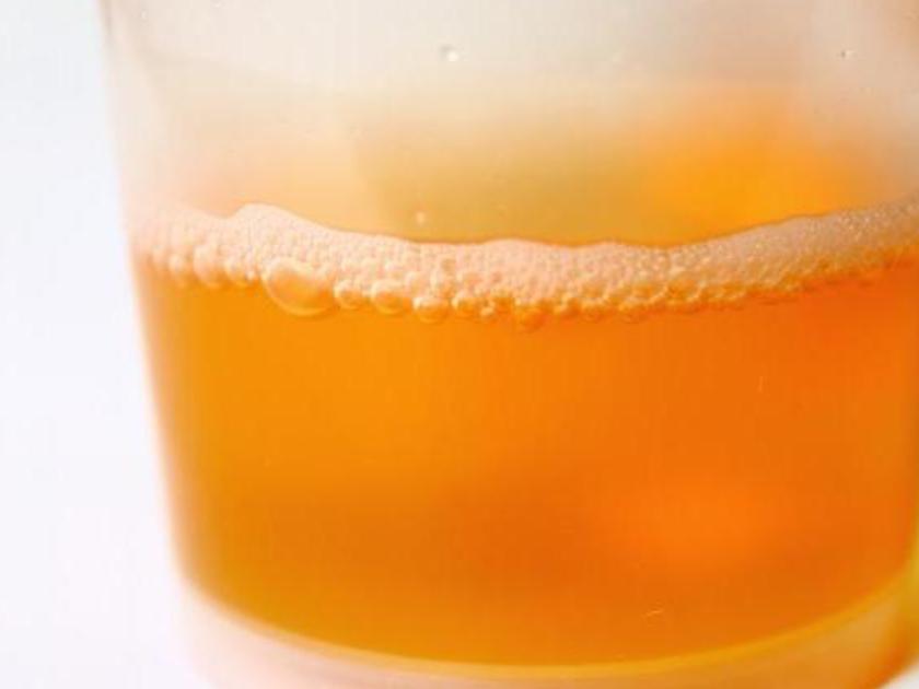 发现小便颜色不对,尿尿颜色不对查什么科