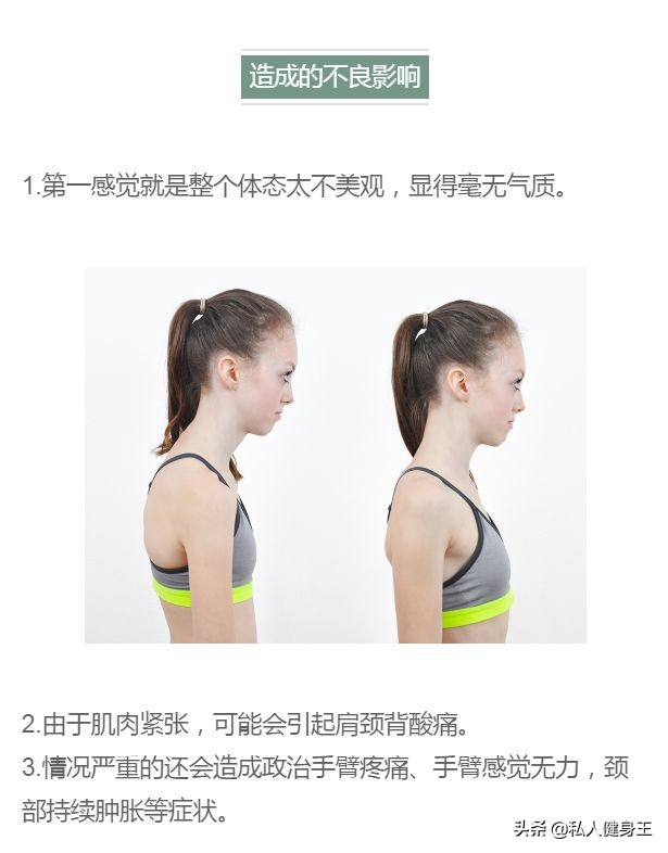 长期玩电脑驼背怎么办,玩电脑形成的驼背怎么改善