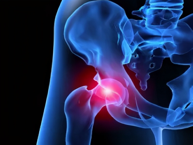 股骨头坏死1期床上康复锻炼,股骨头坏死康复锻炼