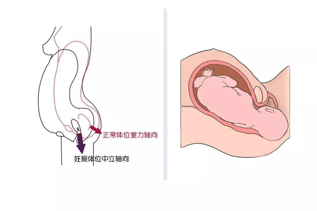 产后8年漏尿如何修复盆底肌,产后七十天漏尿如何修复盆底肌