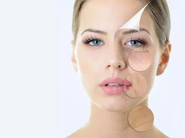 困扰多年的痘痘肌终于好了,困扰了我多年的痘痘终于治好了