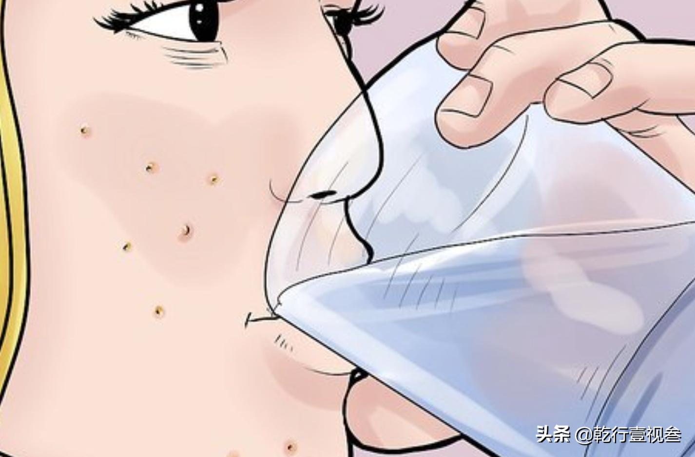 如何预防和祛除青春痘（上）