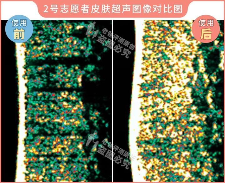 300块的网红美容仪有效果吗,网红家用美容仪测评