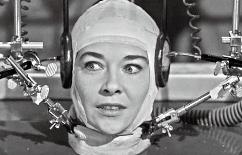 前几年俄罗斯的换头手术咋样了,俄罗斯换头手术成功了吗