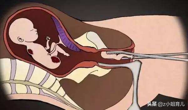 为什么说哺乳期不容易怀孕,有没有姐妹怀疑自己不会怀孕