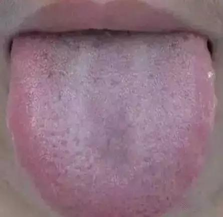 舌头出现信号对身体有什么危险,舌头出现这种症状就要警惕生病了
