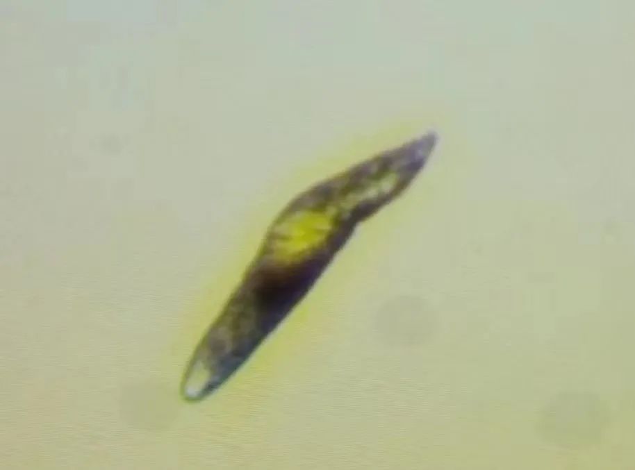 眼睛干涩有螨虫怎么治疗,眼睛干涩痒越揉越痒会不会有螨虫