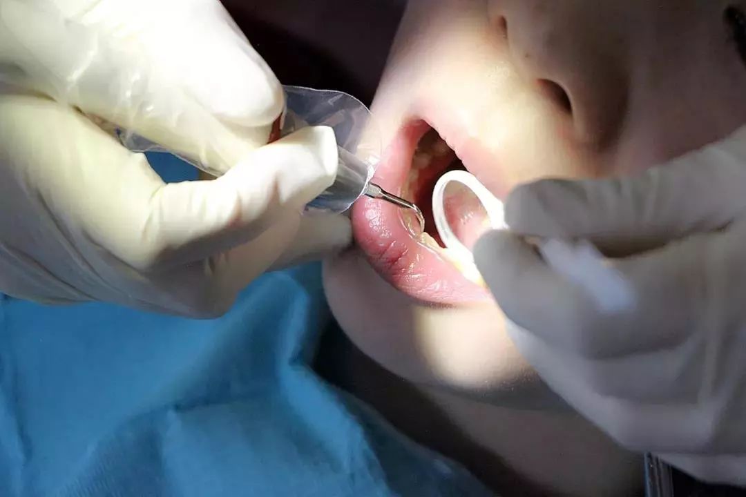 口腔行业进入真正的洗牌期,口腔行业大洗牌