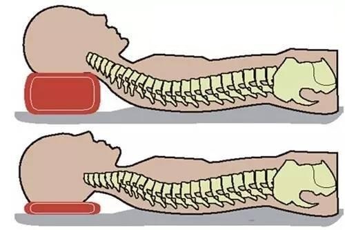 治疗颈椎病的枕头哪个牌子好,颈椎病患者用什么样的枕头好