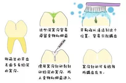 如何让小孩从小拥有一口好牙齿,牙医教小朋友如何保护牙齿