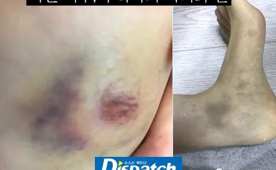 沉默后的具荷拉，沉默着的韩娱圈