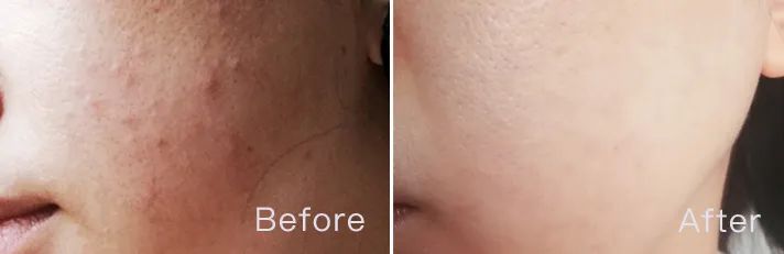 春雨蜂蜜面膜真实测评,春雨蜂蜜面膜用法及功效