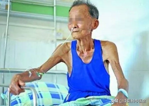 中风后吞咽障碍怎么康复,中风后吞咽困难中医的治疗方法