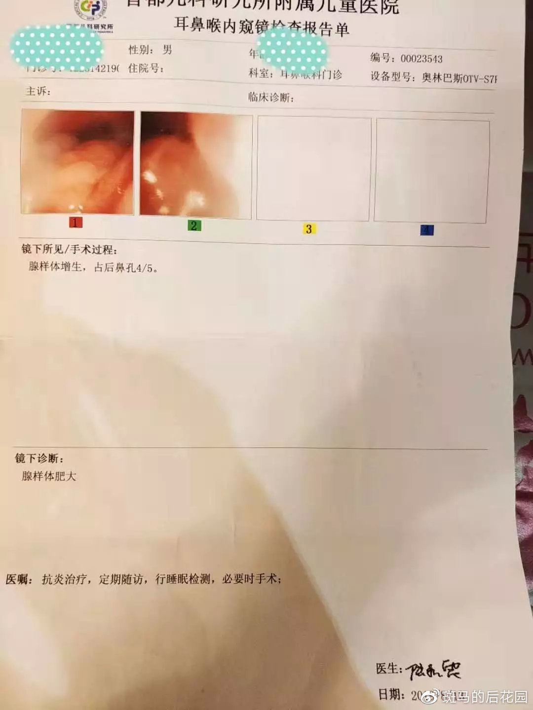 腺样体肥大对长大有什么影响,腺样体长大就萎缩害了多少孩子