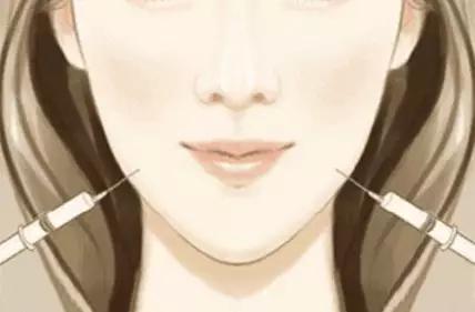 瘦脸针怎么避开腮腺,瘦脸针僵硬感怎么解决