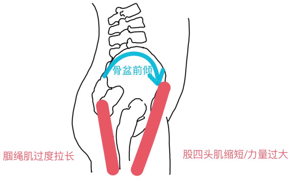 跑步后6个拉伸动作教你拉伸全身,跑步后胫骨前肌肉紧绷