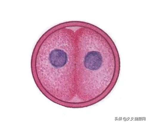 胚胎移植成功后有哪些注意事项,胚胎移植后的常见症状是什么