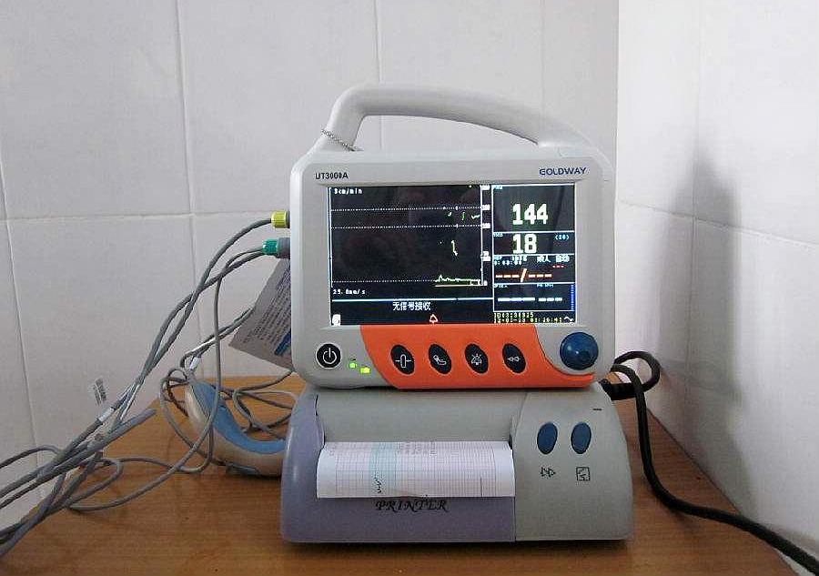 孕33周胎心监测应该在哪个位置,医生如何看胎心监护图