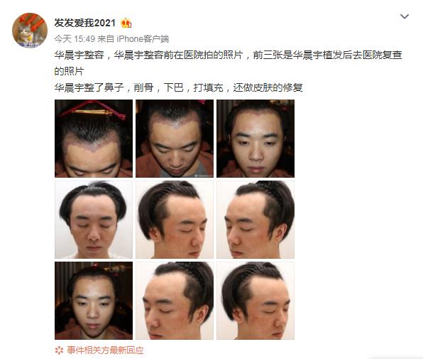 我证明：纯情少年华晨宇真的没有整容没有植发没有情人没有私生子