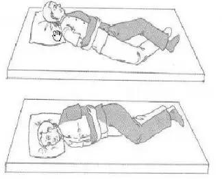 脑卒中如何治疗,脑卒中是什么如何康复治疗