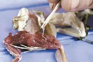 深圳女子零食里吃出铁钉,女子体内取出活虫只因吃这道菜