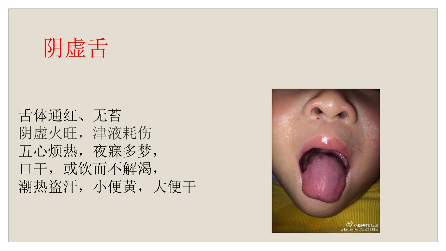 宝宝舌苔怎么辨别热还是寒,如何看宝宝舌苔来区别是否感冒