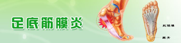 治好足底筋膜炎的一个意外方法,足底筋膜炎严重到无法行走