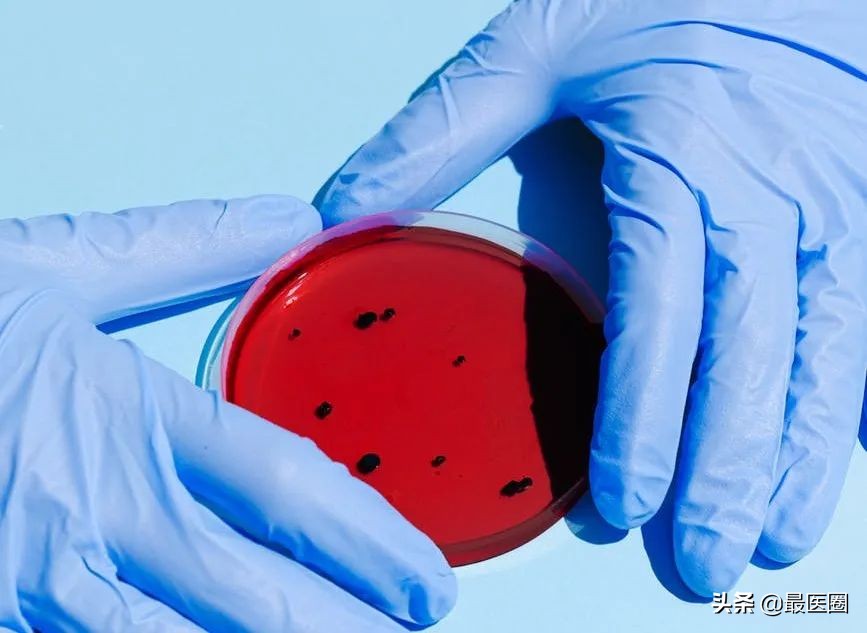 看似平平无奇的尿液，在向我们身体发出了什么警报？