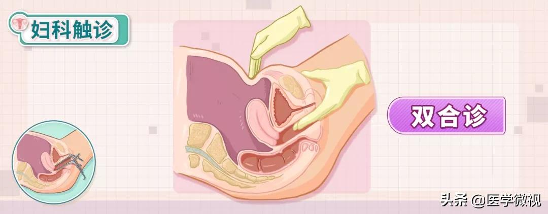 女性多发癌症,女人患上全球仅有300例的罕见肿瘤