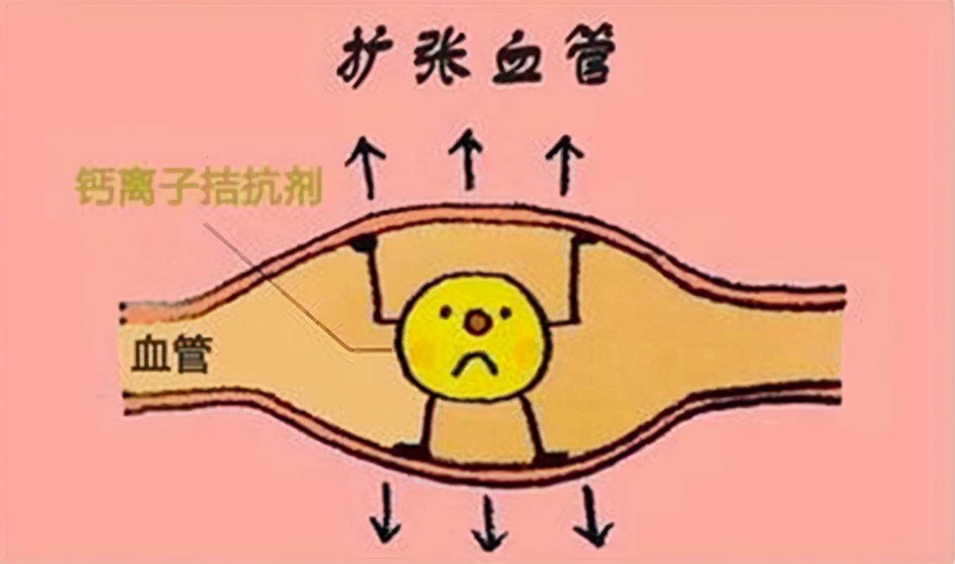 高血压吃着药血压反复升高咋回事,降压药对血管硬化有帮助吗
