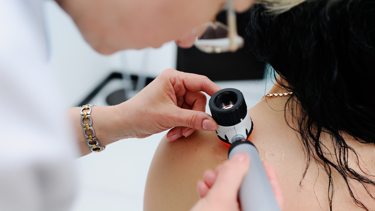 张阿姨得了什么病,张阿姨患病