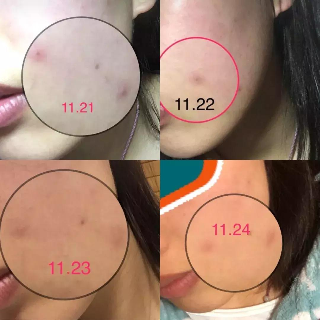 theordinary护肤品推荐,护肤圈成分theordinary