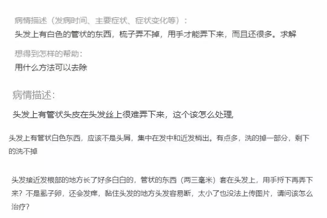 孩子头发上有小白屑是什么,孩子头发上好多白点点是虱子吗