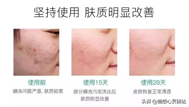 男女通用苦参净螨皂补水效果好吗,苦参皂一款全家都能用的万能皂