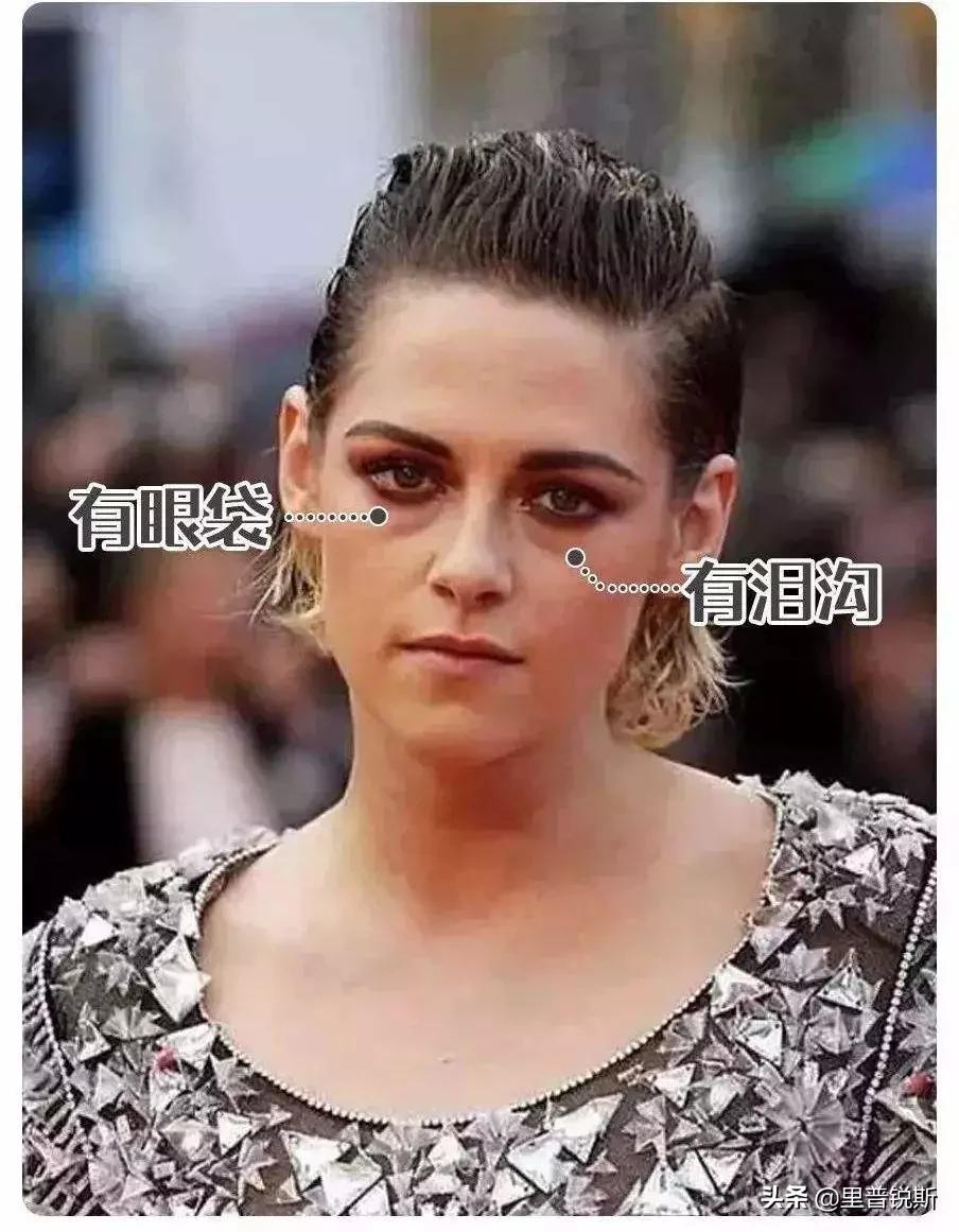 祖传药膏去除眼袋,祖传治疗眼袋