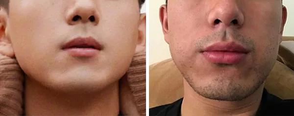 小米最新的剃须刀 (小米众筹599元剃须刀评测)