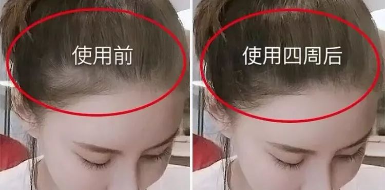 王子文变成儿科医生,王子文变身人形