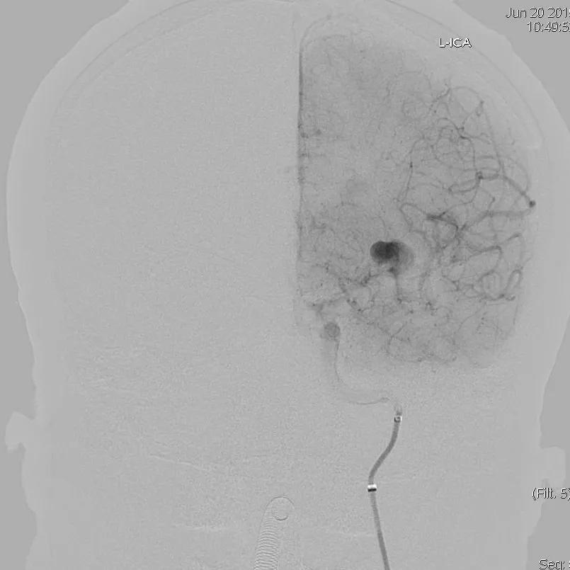 山西省人民医院任少华教授,山西省人民医院任少华
