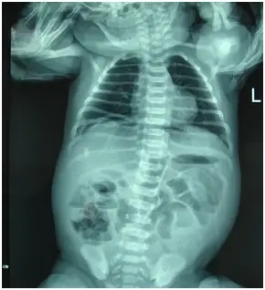 小孩肚子不消化哭闹,小孩肚子痛半夜哭闹如何解决