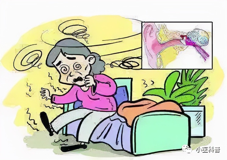 体位性低血压小讲课,体位性低血压帕金森