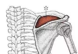 中医怎么看肩膀冈上肌疼痛,肩膀冈上肌疼痛