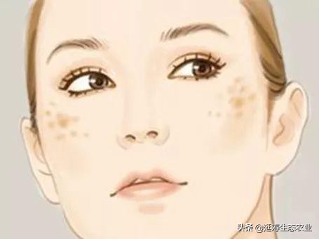 吃什么可以淡化脸上的斑斑点点,消除脸部斑斑点点的秘方